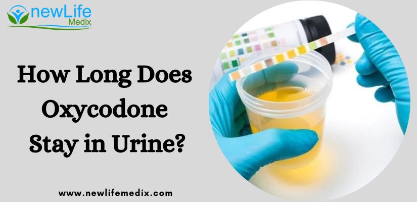 How Long Does Oxycodone Stay in Urine