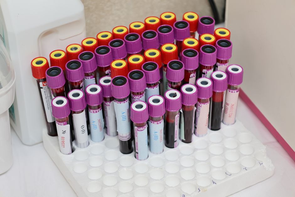 Blood test vials used to detect oxycodone in a laboratory setting