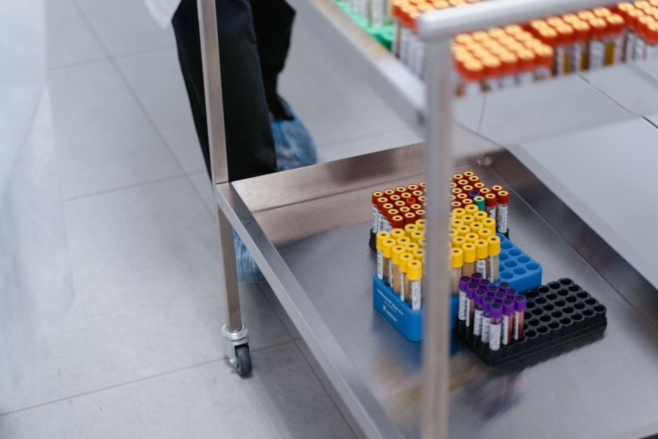 Urine sample cup and blood vials side by side representing oxycodone drug testing comparison
