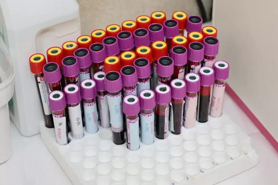 Blood test vials used to detect oxycodone in a laboratory setting